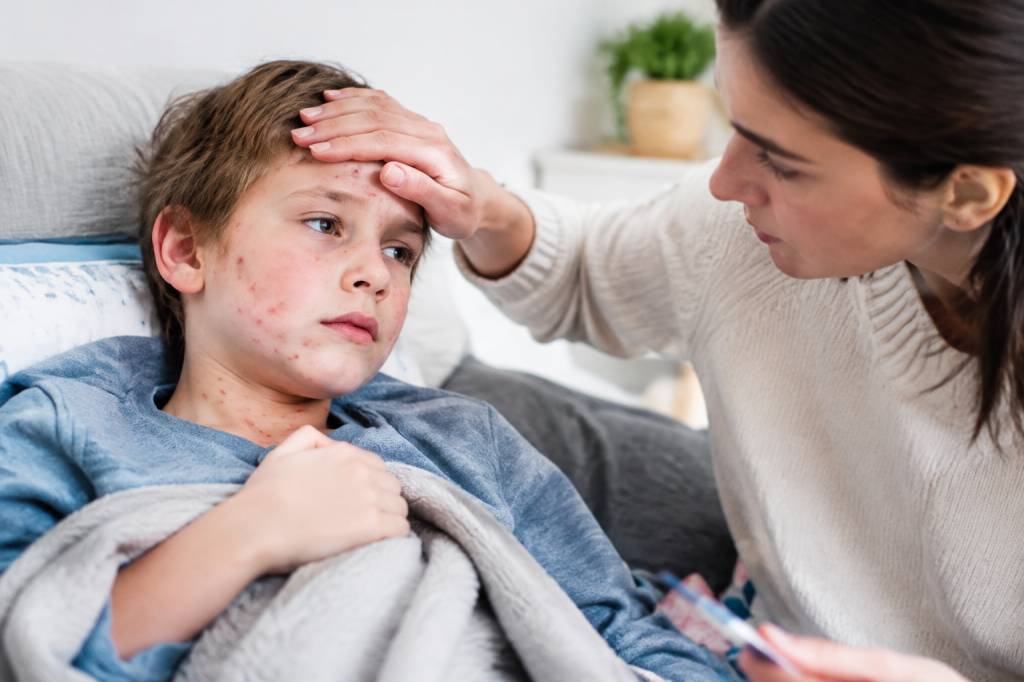 Transmission varicelle : comment se propage le virus et comment limiter les risques ?